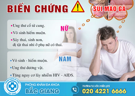 Giải đáp bệnh sùi mào gà là gì?