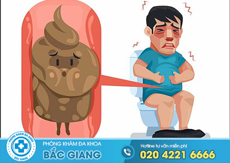Những thông tin cần thiết giải đáp bệnh táo bón là gì?