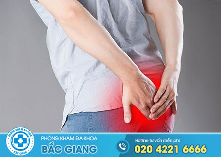 Bệnh trĩ ngoại là gì? Hiểu thế nào cho đúng