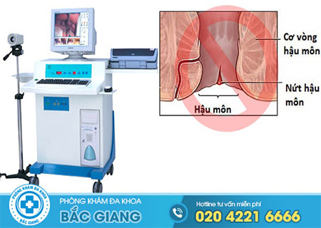 Cách chữa bệnh nứt kẽ hậu môn đảm bảo hiệu quả