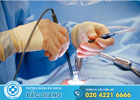 Cách điều trị polyp hậu môn đơn giản, hiệu quả