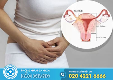 Chi phí điều trị viêm phần phụ