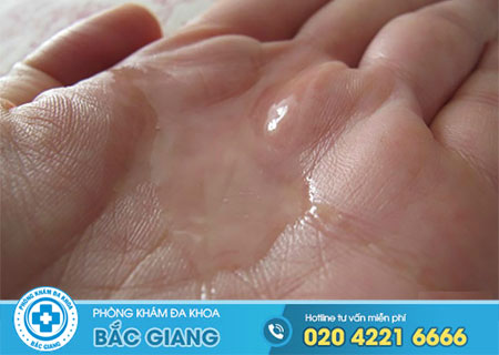 Dấu hiệu không có tinh trùng nam giới không nên bỏ qua