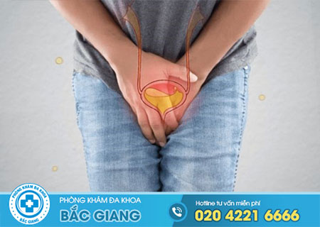 Đau tuyến tiền liệt là bệnh gì