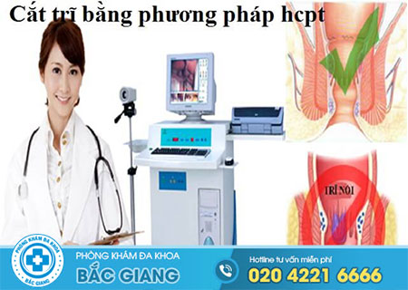 Sự thật về phương pháp cắt trĩ HCPT ?