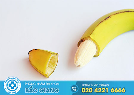 Khi nào nên cắt bao quy đầu?