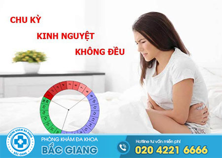 Kinh nguyệt không đều là bệnh gì?