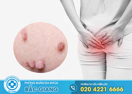 Mọc mụn hậu môn là bệnh gì?