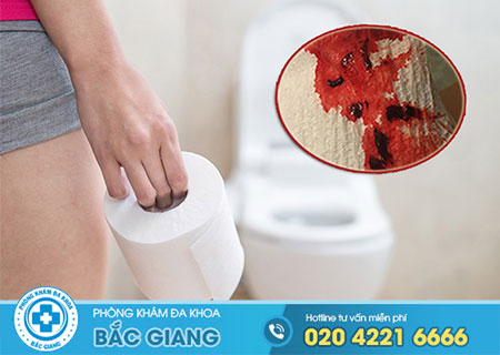 Nguyên nhân gây đi ngoài ra máu bạn cần cảnh giác