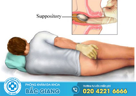 Bật mí phương pháp điều trị bệnh trĩ nội an toàn, hiệu quả