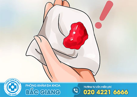 Quan hệ ra máu ở nữ là bệnh gì?