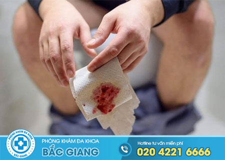 Tác hại của bệnh sa trực tràng