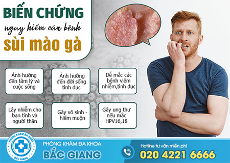 Cảnh báo những tác hại của bệnh sùi mào gà