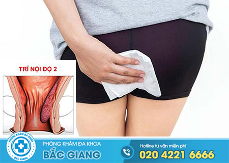 tác hại của bệnh trĩ nội có thể bạn chưa biết