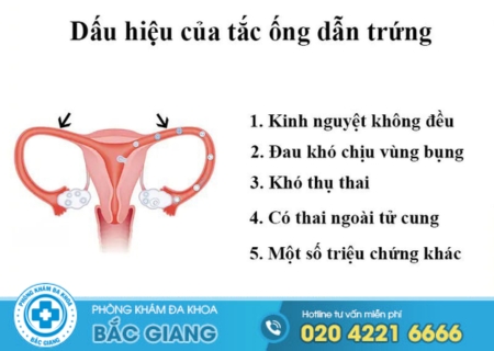 Địa chỉ điều trị tắc ống dẫn trứng