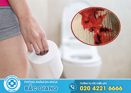 Triệu chứng bệnh polyp hậu môn không nên chủ quan