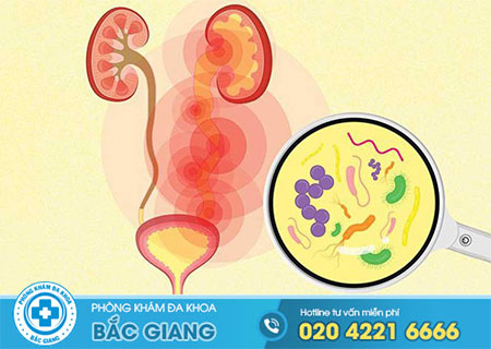 Triệu chứng của bệnh viêm niệu đạo