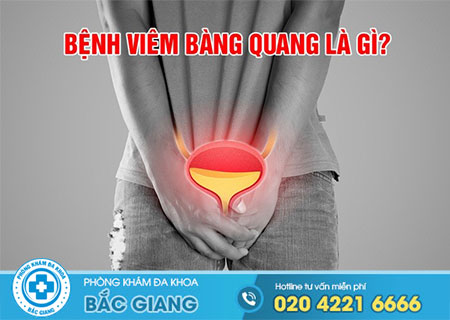 Viêm bàng quang là gì?