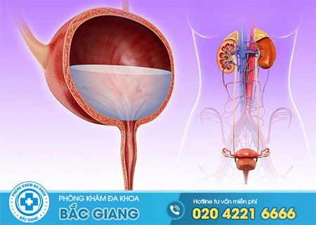 Viêm đường tiết niệu