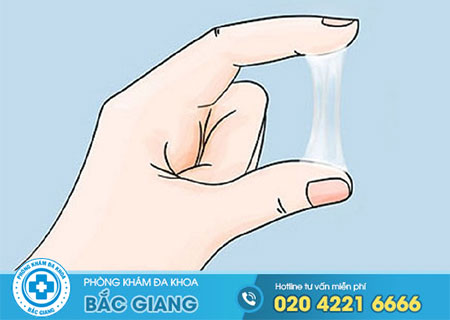 Âm đạo ra nhiều khí hư