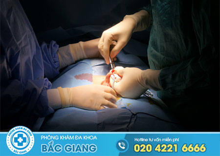 Bao quy đầu có cần thiết cắt không?