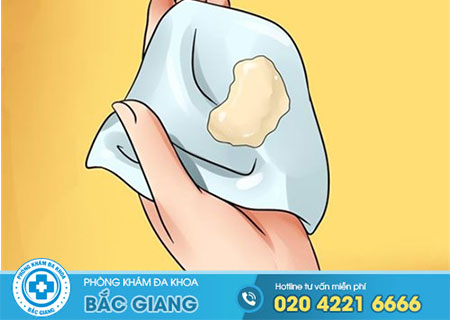 Bị ra nhiều khí hư màu vàng cảnh báo bệnh gì? Cách điều trị hiệu quả