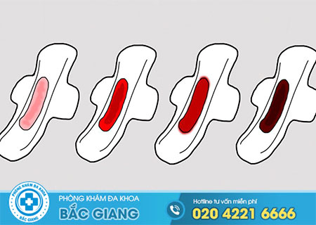 Biểu hiện của viêm buồng trứng
