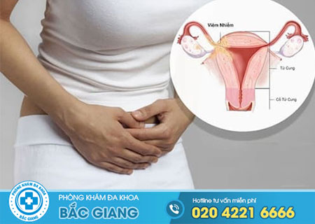 Biểu hiện của viêm vùng kín chị em nhất định phải biết