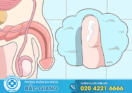 Các bệnh nam khoa đường tình dục bạn nên biết