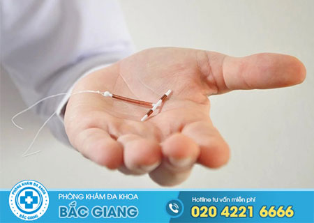 chi phí đặt vòng tránh thai