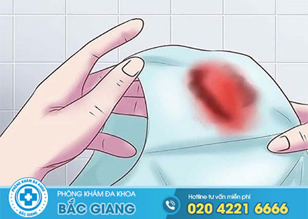 Có kinh sớm có thai không?Cách nhận biết có thai