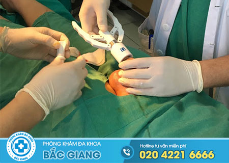 Dài bao quy đầu là gì? Cách chữa dài bao quy đầu như thế nào?