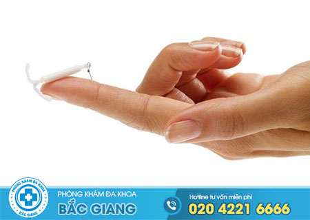 Địa chỉ đặt vòng tránh thai uy tín