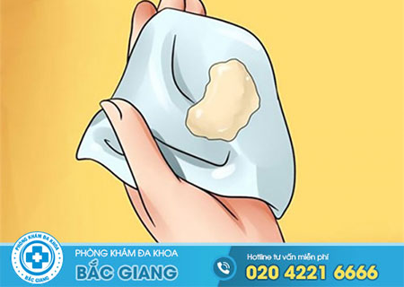 Bắt bệnh phụ khoa qua hiện tượng ra khí hư nhiều