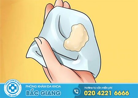 Khí hư ra nhiều đau vùng thắt lưng có phải dấu hiệu nguy hiểm không?