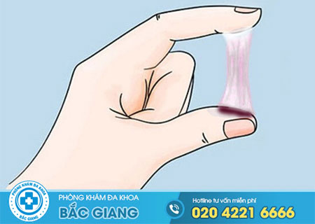 Khi quan hệ ra dịch màu nâu