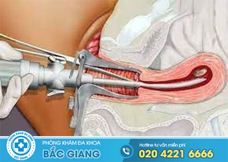 Lý giải vấn đề phá thai có nguy hiểm không?