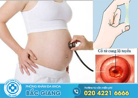Mang thai bị viêm lộ tuyến ảnh hưởng gì?
