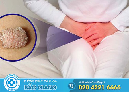 Môi bé sần sùi là gì? Có nguy hiểm không?