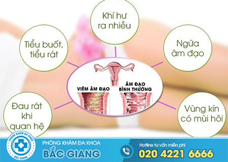 Những dấu hiệu bệnh phụ khoa
