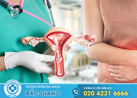 Polyp cổ tử cung có tái phát không?