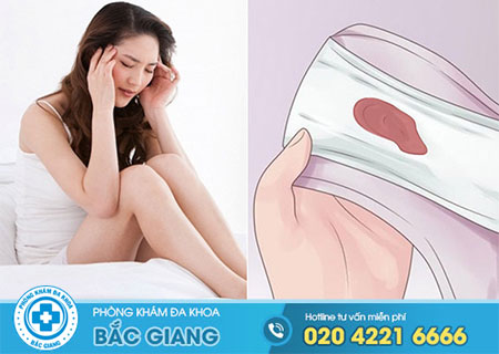 Ra dịch màu nâu sâu khi hút thai cần chú ý điều gì?