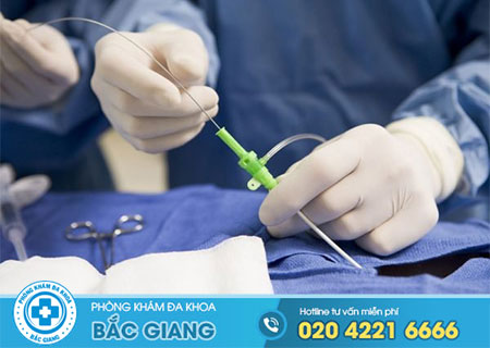 Sau sạch kinh bao lâu thì đốt viêm lộ tuyến