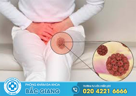 Sùi mào gà ở nữ có chữa khỏi không?