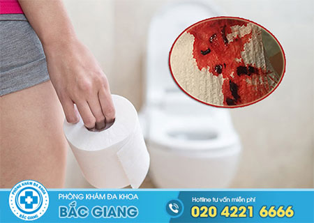Bị chảy máu hậu môn phải làm sao?