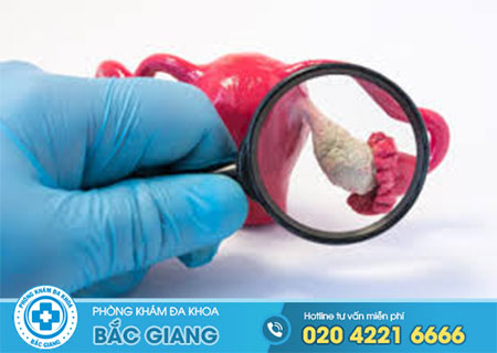 Bị u nang buồng trứng có quan hệ được không?