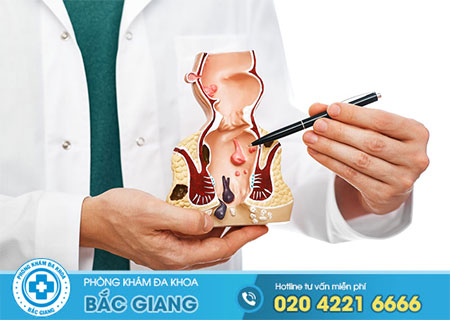 Điều trị bệnh trĩ ở đâu tốt nhất?