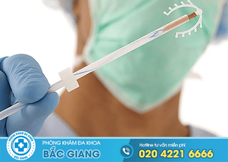 Đặt vòng tránh thai có an toàn