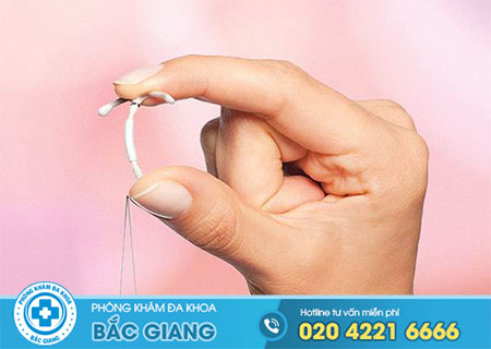 Vòng tránh thai bị tụt thấp