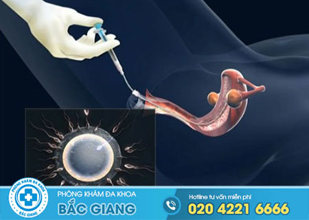 Bơm tinh trùng mấy lần thì có thai